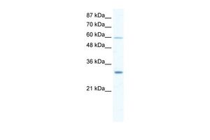 Anti-DDX31 antibody, N-term used in Western blot. GTX47501