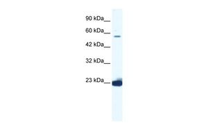 Anti-DDX55 antibody, C-term used in Western blot. GTX47503
