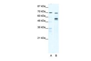Anti-DDX55 antibody, N-term used in Western blot. GTX47504