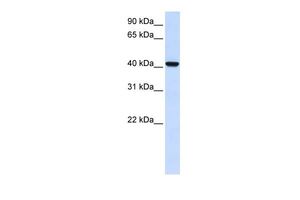 Anti-DGAT2L4 antibody, C-term used in Western blot. GTX46730