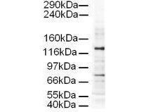 Anti-Ap3D1 antibody used in Western blot. GTX23705