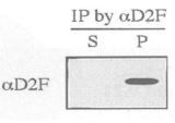 Anti-Dis2 (S. pombe) antibody used in Immunoprecipitation. GTX64106