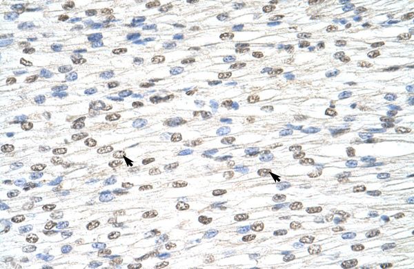 Anti-DIS3L2 antibody, N-term used in IHC (Formalin-fixed paraffin-embedded sections). GTX47208