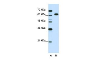 Anti-DIS3L2 antibody, N-term used in Western blot. GTX47208