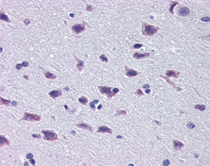 Anti-DMBX1 antibody, Internal used in IHC (Formalin-fixed paraffin-embedded sections). GTX48986