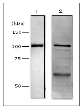 Anti-DNA Polymerase I (E coli) antibody used in Western blot. GTX64108