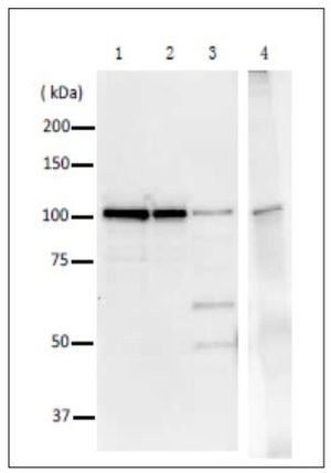 Anti-DNA Polymerase I (E coli) antibody used in Immunoprecipitation. GTX64108