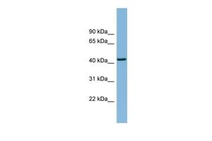 Anti-DNAJB12 antibody, Internal used in Western blot. GTX46726