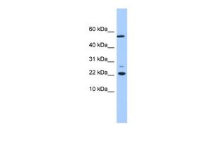 Anti-DPH4 antibody, N-term used in Western blot. GTX45537