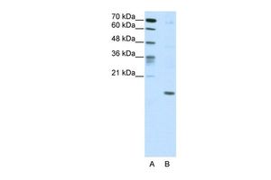 Anti-DUX5 antibody, C-term used in Western blot. GTX49001