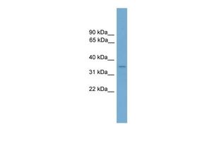 Anti-DUXBL1 antibody, Internal used in Western blot. GTX48992