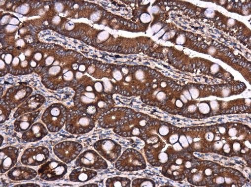 Anti-DYNC1LI1 antibody used in IHC (Formalin-fixed paraffin-embedded sections). GTX120114