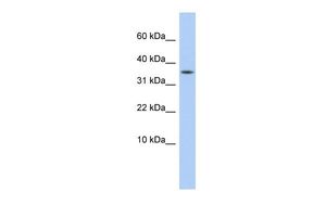 Anti-DYSFIP1 antibody, Internal used in Western blot. GTX45844