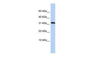 Anti-DYSFIP1 antibody, Internal used in Western blot. GTX45845