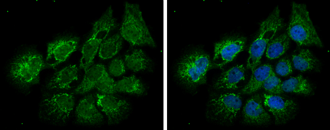 Anti-ECHS1 antibody [N1C2] used in Immunocytochemistry/ Immunofluorescence. GTX114376