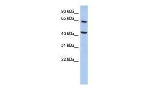 Anti-EFHA2 antibody, N-term used in Western blot. GTX45190