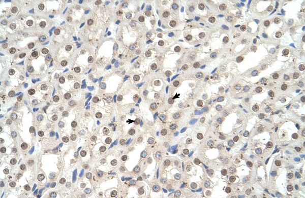Anti-EHF antibody, N-term used in IHC (Formalin-fixed paraffin-embedded sections). GTX49008