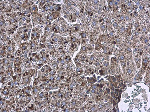 Anti-Apolipoprotein D antibody used in IHC (Formalin-fixed paraffin-embedded sections). GTX101306