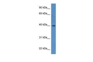 Anti-ELMOD3 antibody, C-term used in Western blot. GTX49049