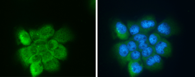 Anti-Apolipoprotein D antibody used in Immunocytochemistry/ Immunofluorescence. GTX101306