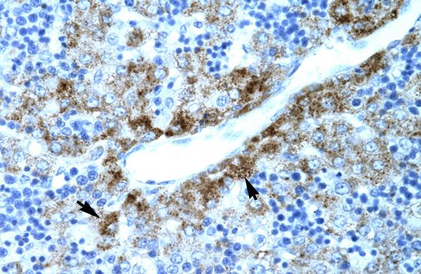 Anti-Embryonic Lung Protein antibody, N-term used in IHC (Formalin-fixed paraffin-embedded sections). GTX77854