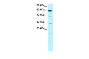 Anti-Embryonic Lung Protein antibody, N-term used in Western blot. GTX77854