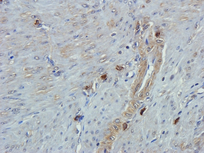 Anti-Emp1 antibody used in IHC (Formalin-fixed paraffin-embedded sections). GTX37707