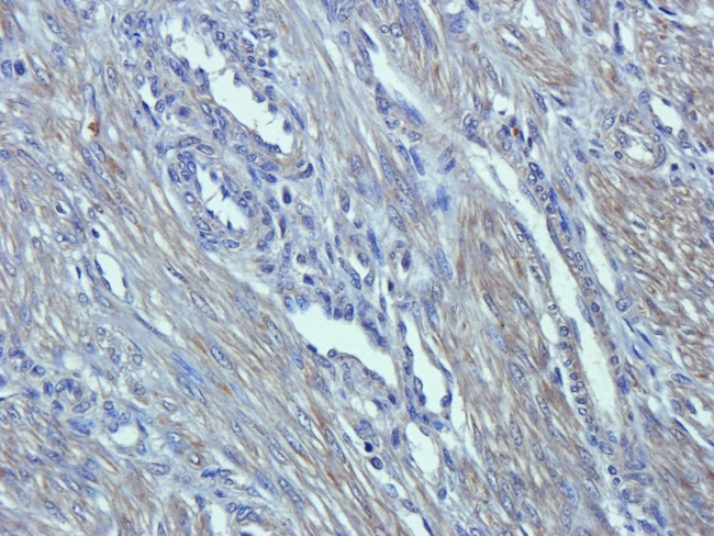 Anti-Emp1 antibody used in IHC (Formalin-fixed paraffin-embedded sections). GTX37707