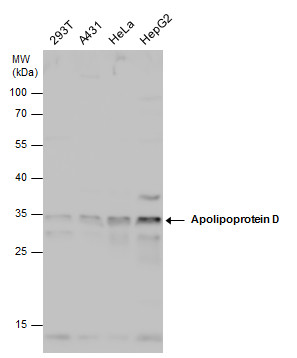 Anti-Apolipoprotein D antibody used in Western blot. GTX101306
