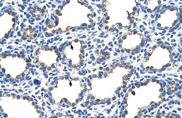 Anti-EMP2 antibody, Internal used in IHC (Formalin-fixed paraffin-embedded sections). GTX47154