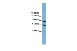 Anti-EXOC6 antibody, N-term used in Western blot. GTX44929