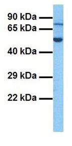 Anti-EXOC8 antibody, N-term used in Western blot. GTX45557