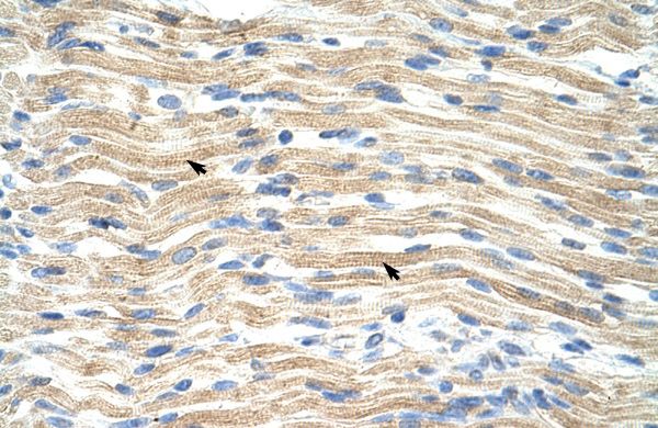 Anti-EXOSC6 antibody, N-term used in IHC (Formalin-fixed paraffin-embedded sections). GTX47229