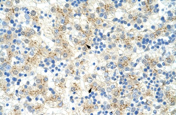 Anti-EXOSC6 antibody, N-term used in IHC (Formalin-fixed paraffin-embedded sections). GTX47229