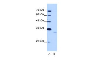 Anti-EXOSC6 antibody, N-term used in Western blot. GTX47230
