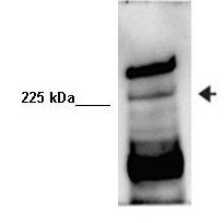 Anti-EXPH5 antibody, Internal used in Western blot. GTX47026
