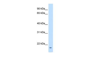 Anti-FAM107A antibody, Internal used in Western blot. GTX47042