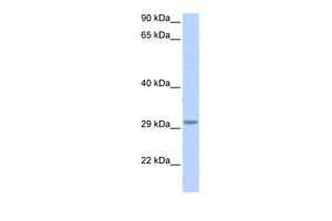 Anti-FAM108B1 antibody, Internal used in Western blot. GTX45024