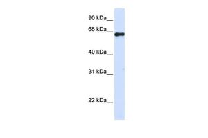 Anti-FAM116A antibody, Internal used in Western blot. GTX45505