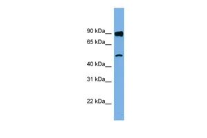 Anti-FAM160B1 antibody, N-term used in Western blot. GTX44901