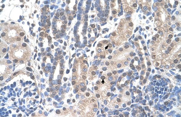 Anti-FAM174B antibody, C-term used in IHC (Formalin-fixed paraffin-embedded sections). GTX46959