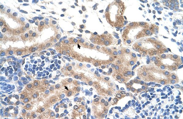 Anti-FAM174B antibody, N-term used in IHC (Formalin-fixed paraffin-embedded sections). GTX46960