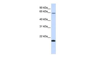 Anti-FAM19A3 antibody, Internal used in Western blot. GTX46711