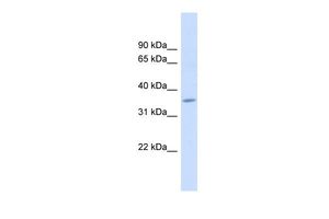 Anti-FAM26F antibody, Internal used in Western blot. GTX46676