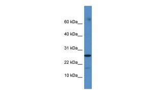 Anti-FAM36A antibody, C-term used in Western blot. GTX45525