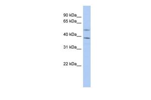 Anti-FAM46A antibody, N-term used in Western blot. GTX47012