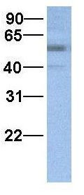 Anti-FAM46A antibody, N-term used in Western blot. GTX47012