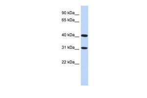 Anti-FAM46D antibody, Internal used in Western blot. GTX45632
