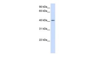 Anti-FAM54A antibody, Internal used in Western blot. GTX45824