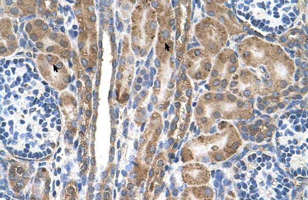Anti-FAM55D antibody, C-term used in IHC (Formalin-fixed paraffin-embedded sections). GTX46583